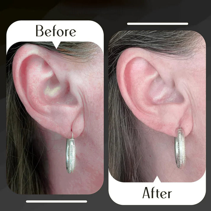Earlobe Support Patches (100 PCS)