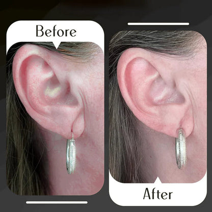 Earlobe Support Patches (100 PCS)